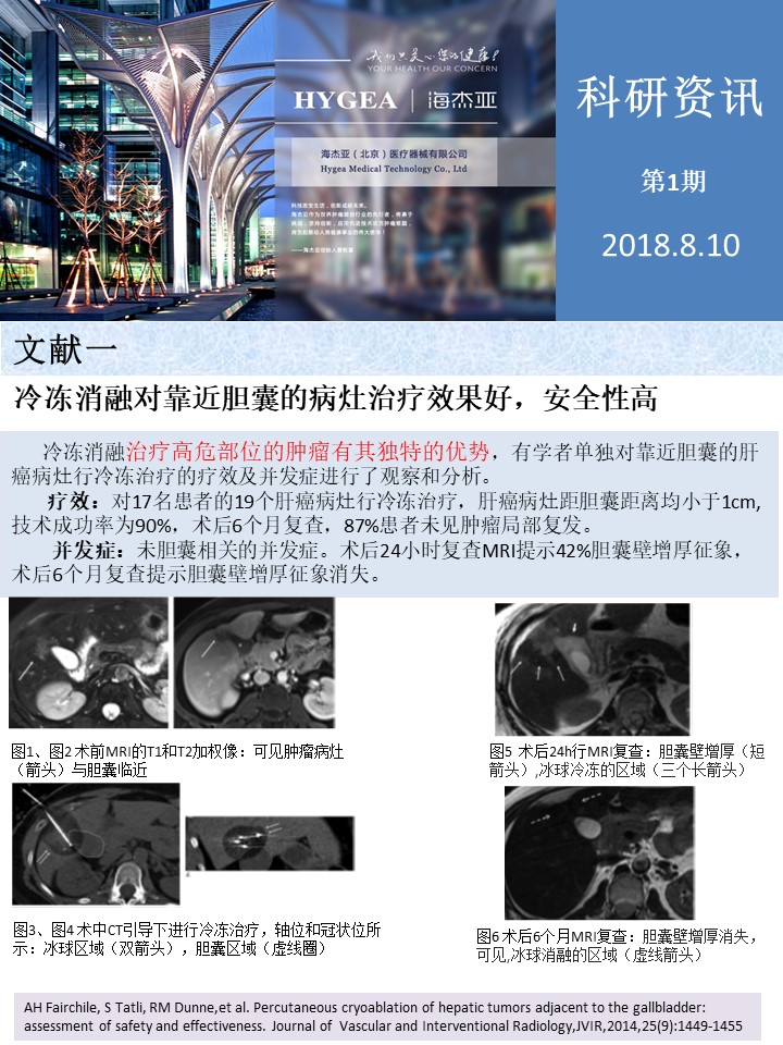 【海杰亞科研資訊】第1期——肝、肺癌消融